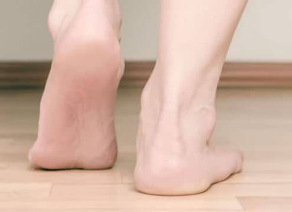 Flat Feet & Fallen Arches Specialist Flat Feet Treatment
